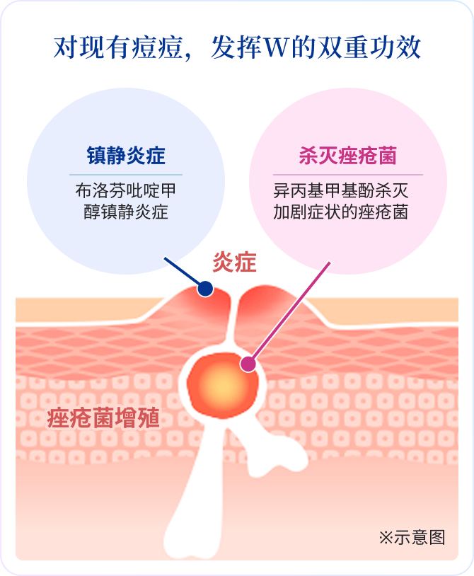 对现有痘痘，发挥W的双重功效 镇静炎症 布洛芬吡啶甲醇镇静炎症 杀灭痤疮菌 异丙基甲基酚杀灭加剧症状的痤疮菌 ※示意图