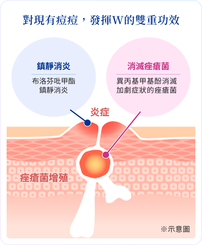 對現有痘痘，發揮W的雙重功效 鎮靜消炎 布洛芬吡甲酯鎮靜消炎 消滅痤瘡菌 異丙基甲基酚消滅加劇症狀的痤瘡菌 ※示意圖