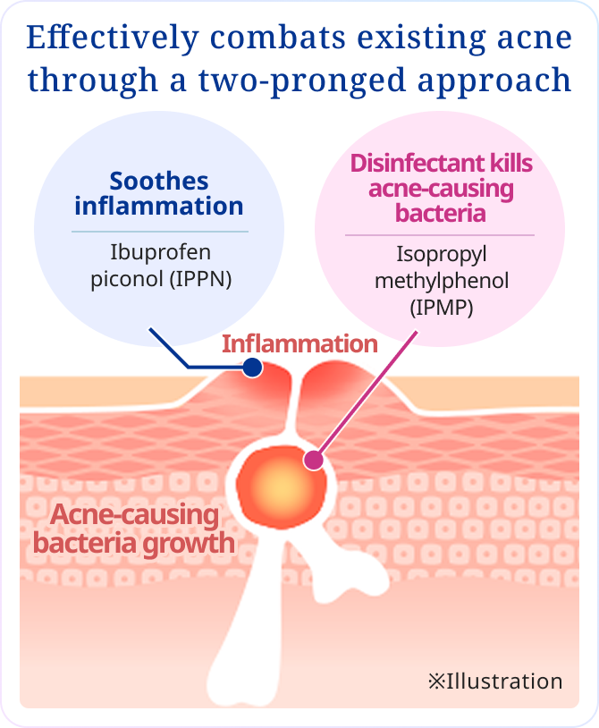 Effectively combats existing acne through a two-pronged approach Soothes inflammation Ibuprofen piconol (IPPN) Disinfectant kills acne-causing bacteria Isopropyl methylphenol (IPMP) ※Illustration