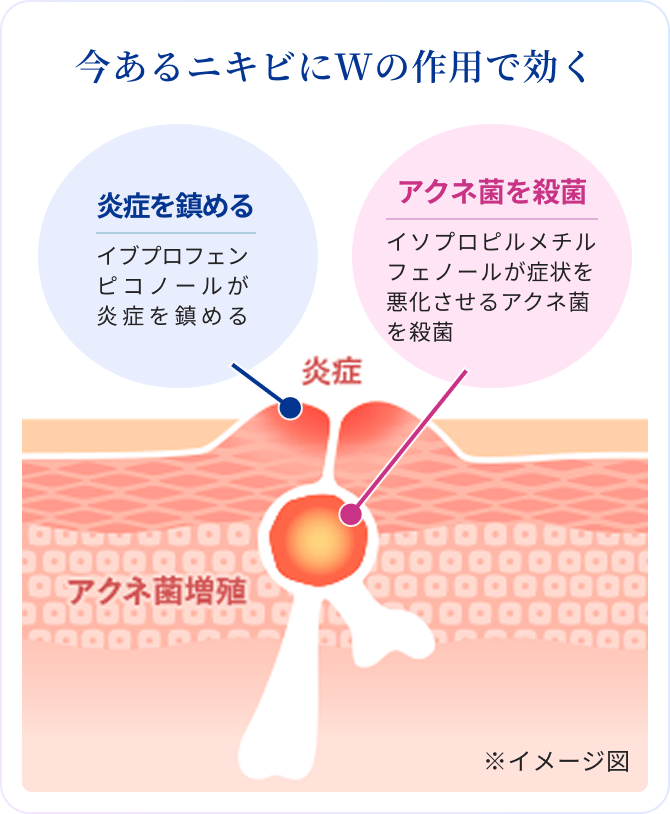今あるニキビにWの作用で効く 炎症を鎮める イブプロフェンピコノールが炎症を鎮める アクネ菌を殺菌 イソプロピルメチルフェノールが症状を悪化させるアクネ菌を殺菌 ※イメージ図