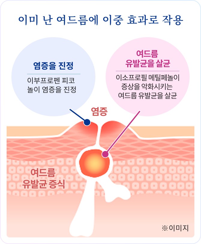 이미 난 여드름에 이중 효과로 작용 염증을 진정 이부프로펜 피코놀이 염증을 진정 여드름 유발균을 살균 이소프로필 메틸페놀이 증상을 악화시키는 여드름 유발균을 살균 ※이미지